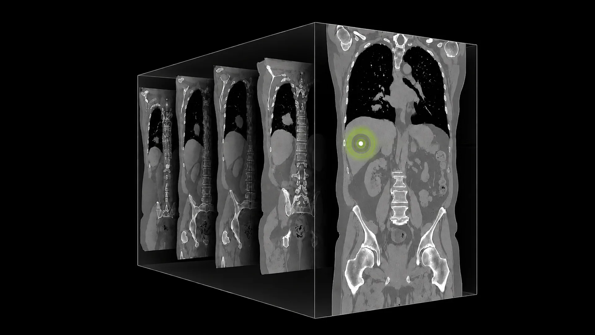 ct-scan-image